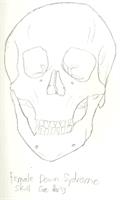 Female Down Symdrome Skull